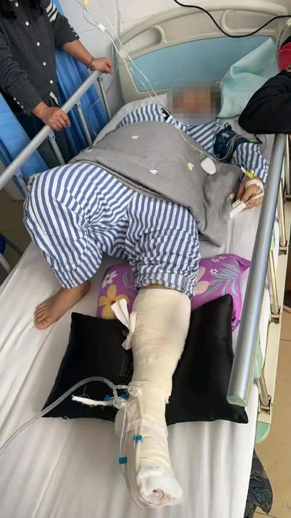 充电玩手机引电击 女子多处受伤